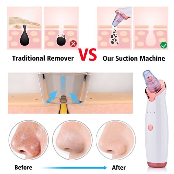 Blackhead Instrument Electric Suction Facial Washing Instrument Beauty Acne Cleaning Blackhead Suction Instrument - Image 10